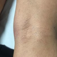 Same patient as previous image