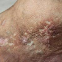
	Same patient as previous image