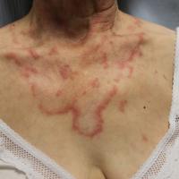
	Same patient as previous image