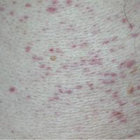 
	Close-up of the previous image