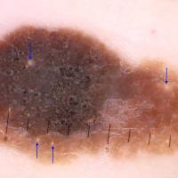 What is the diagnosis?Refer to the next…