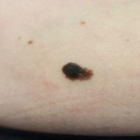 Clinical appearance of previous…