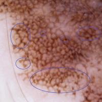 Close-up of previous figureCopied with kind…