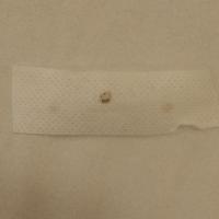 The Hypafix tape after tape-stripping