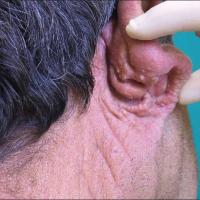 
	Same patient as previous image

	Copied with…