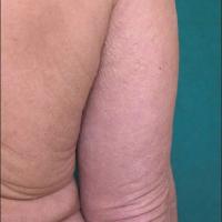 
	Same patient&nbsp;

	Copied with kind…