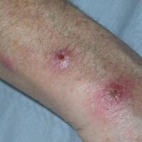 
	Same patient as previous image