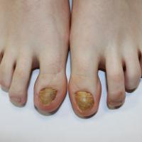 
	Nail trauma in a young woman

	This problem is…