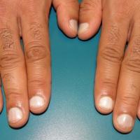 
	Terry's nails&nbsp;

	Copied with kind…
