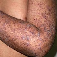 
	Same patient as previous image
