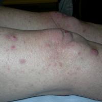 
	Same patient as previous image
