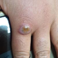 
	Orf

	Copied with kind permission from&nbsp;Dr…