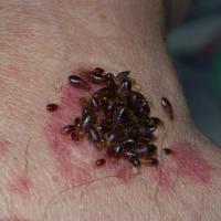 
	Bed bugs