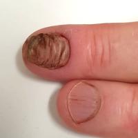 Same patient as previous figure
Copied with kind…
