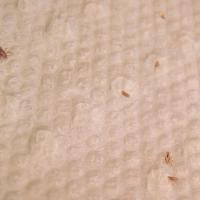 
	Head lice
