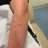 Same patient as previous image
Copied with kind…