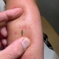 Same patient as previous image
Copied with kind…