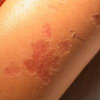 
	Close-up of previous image
	
	Arrow denotes…