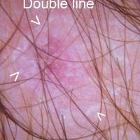 
	As previous image

	Parallel 'tram' lines at…