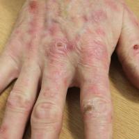 
	Same patient as previous image
