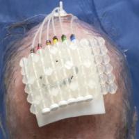 
	During treatment

	Copied with kind permission…