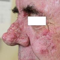 
	Same patient as figure 14 