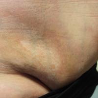 
	Close-up of the previous…