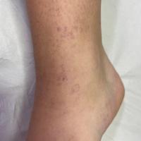 Same patient as previous figure
Copied with kind…