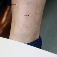 
	Close-up of figure 4