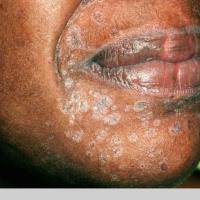 
	Same patient as previous image