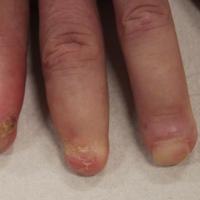 
	Same patient as previous image

	Copied with…