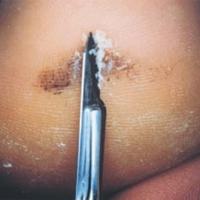 
	Same patient as figure 3
	
	The diagnosis can…