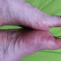 Same case as previous image