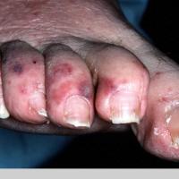 
	Same patient as previous image