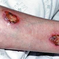 
	Same patient as previous image