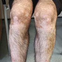 
	Same patient as previous image