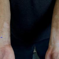 
	Same patient 

	The same treatment did not…