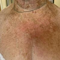 The same patient as previous figure&nbsp;6-8…
