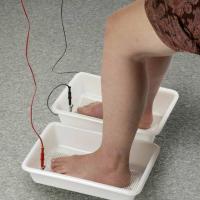 
	Iontophoresis for palmar and plantar…