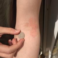
	Hold a coin or ruler in the photo for scale