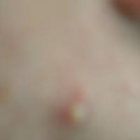 
	Camera is too close to the skin to focus on the…